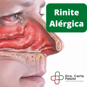 Rinite alérgica 1